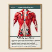 Diagramme des points de déclenchement