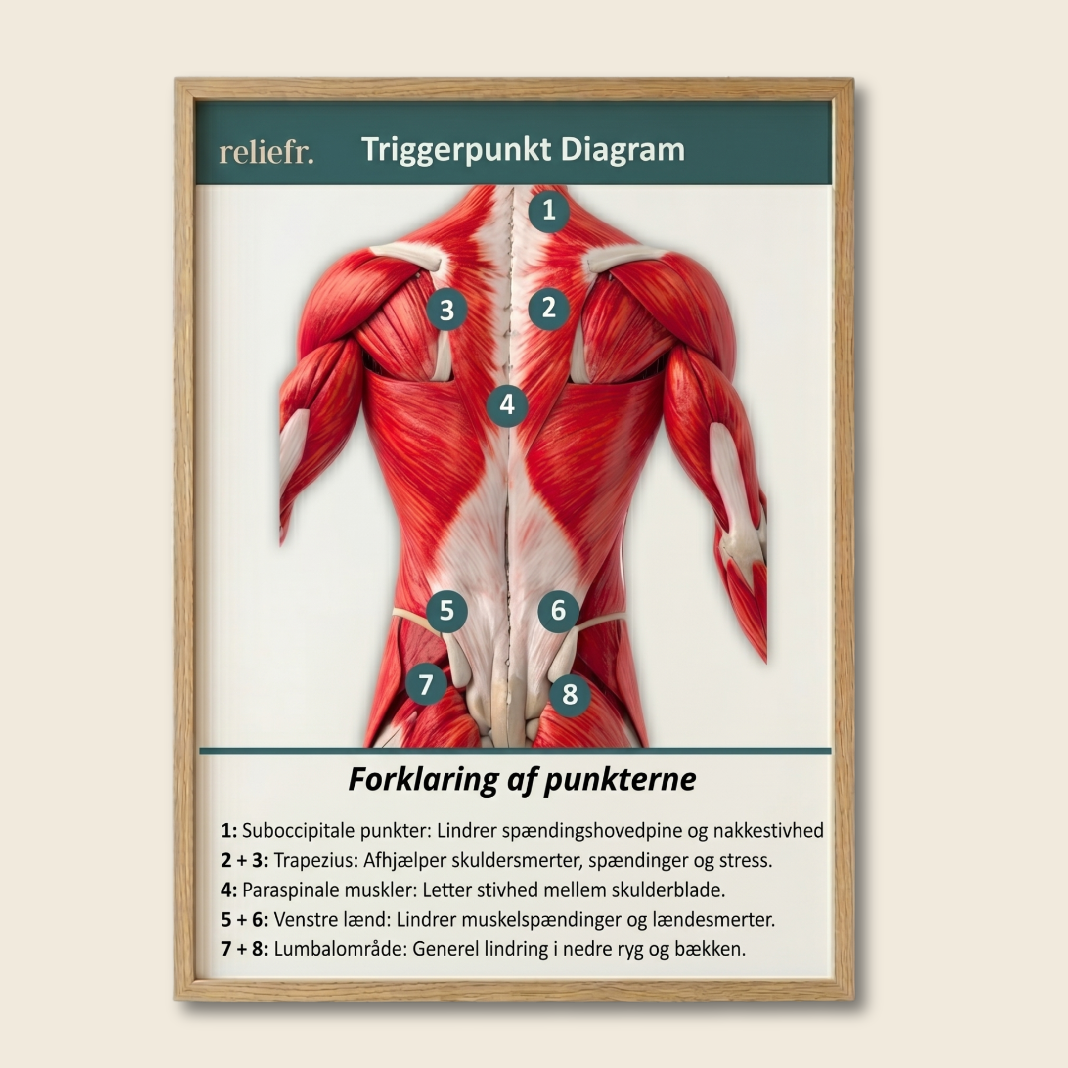Diagramme des points de déclenchement